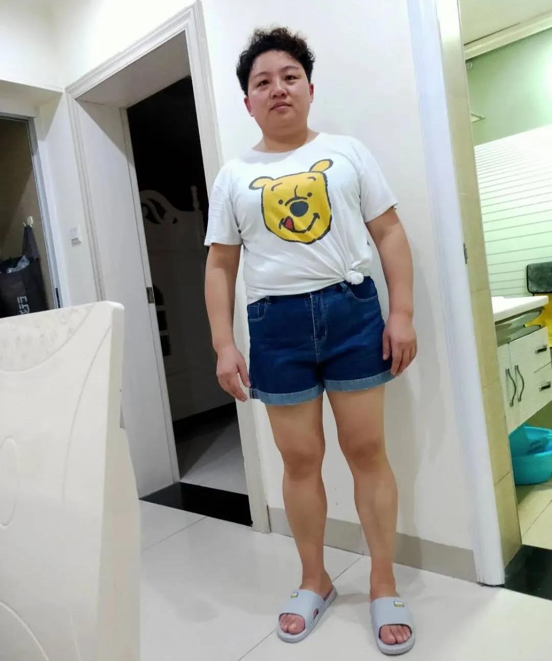 减肥案例 减肥案例