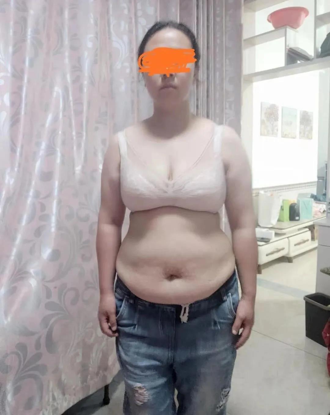 减肥案例 减肥案例